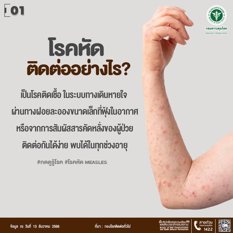 โรคหัด