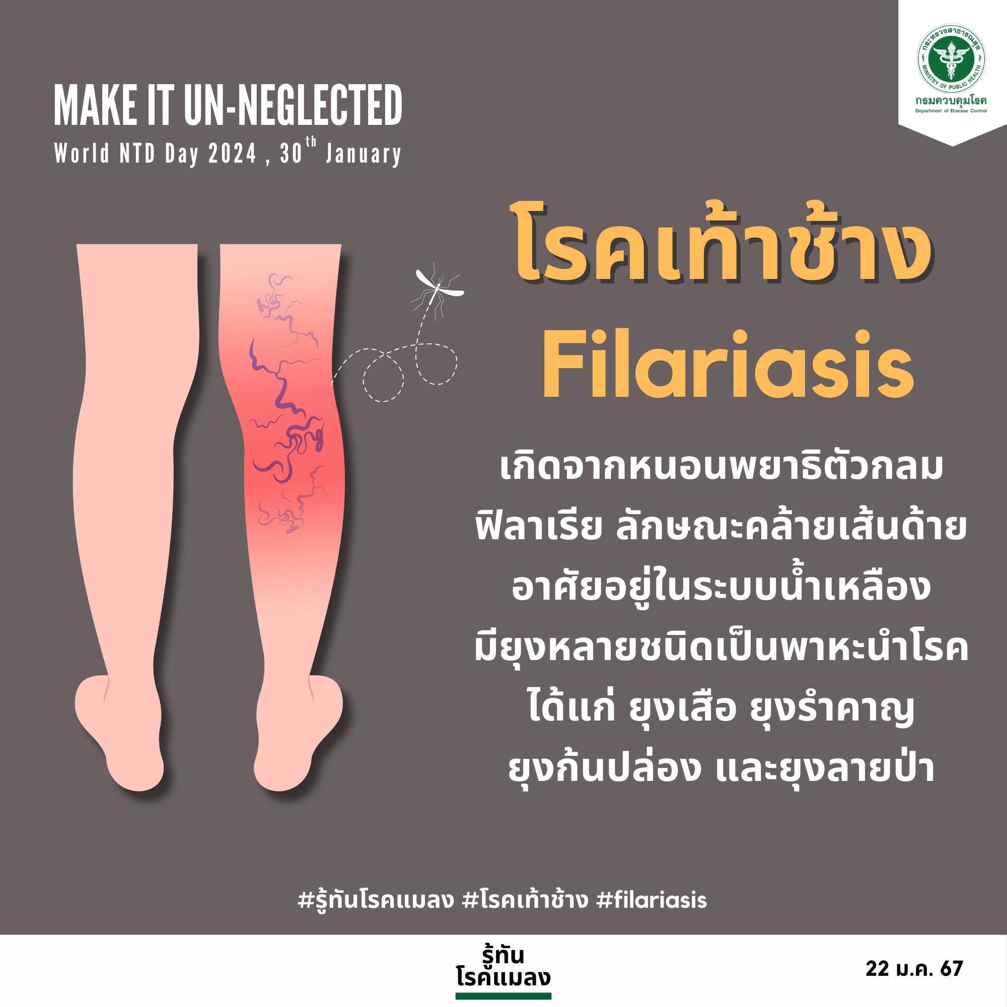 โรคเท้าช้าง